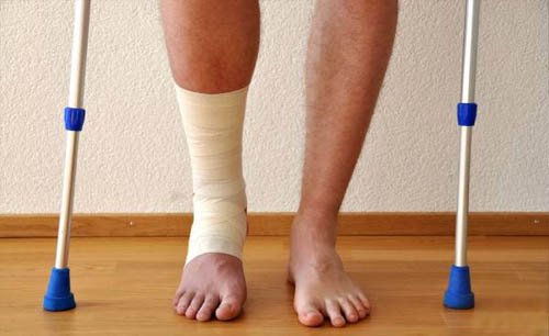 Ankle Injury Treatment