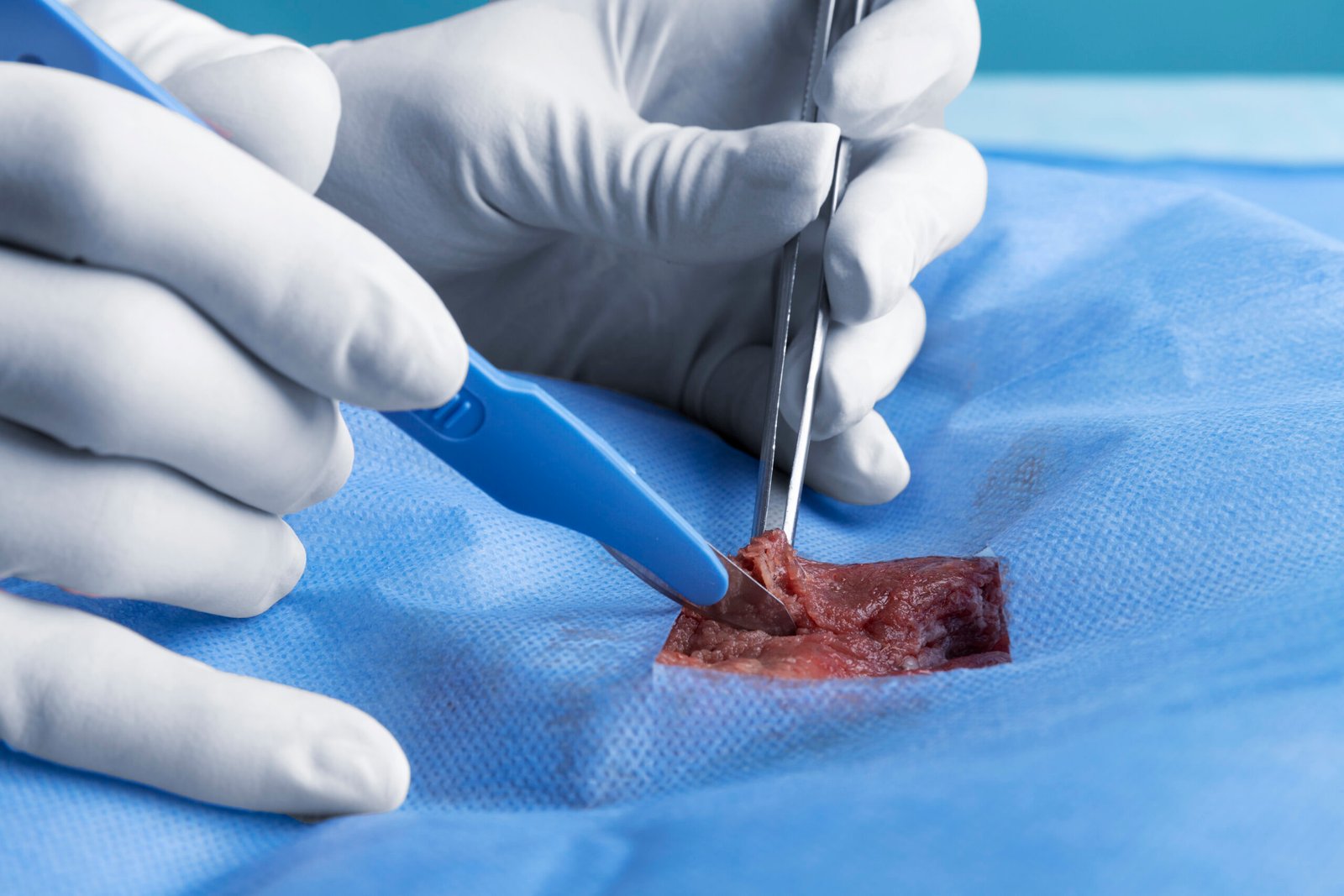 Arthroscopic Assisted Fusions