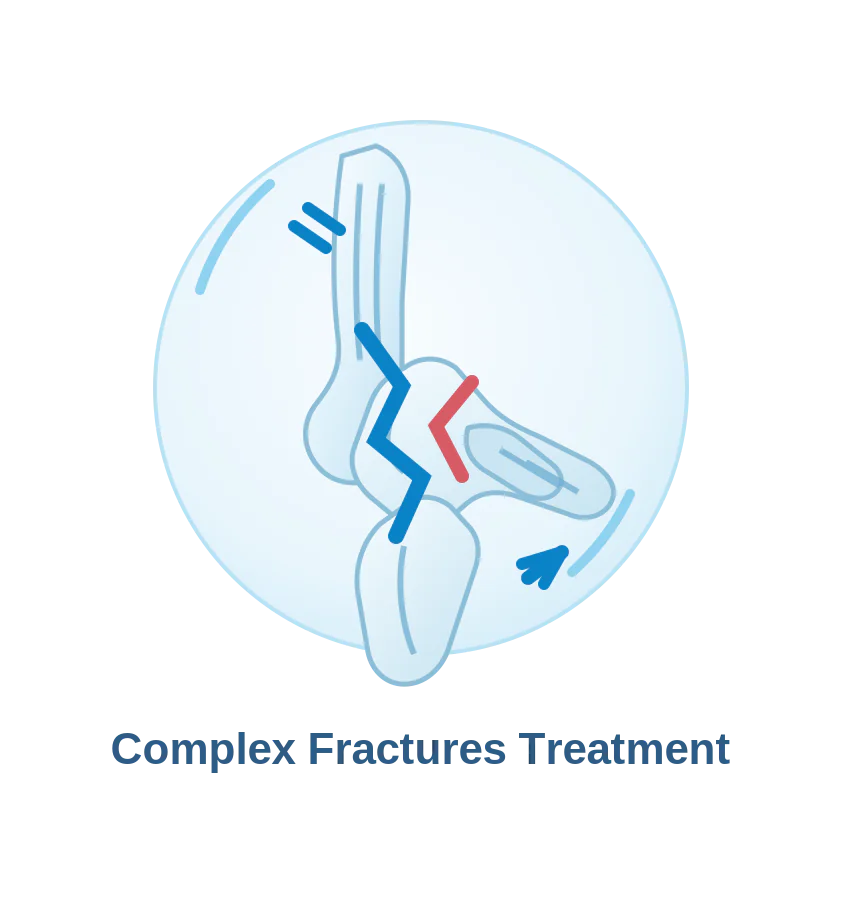 Complex ankle fracture evaluation and surgical care