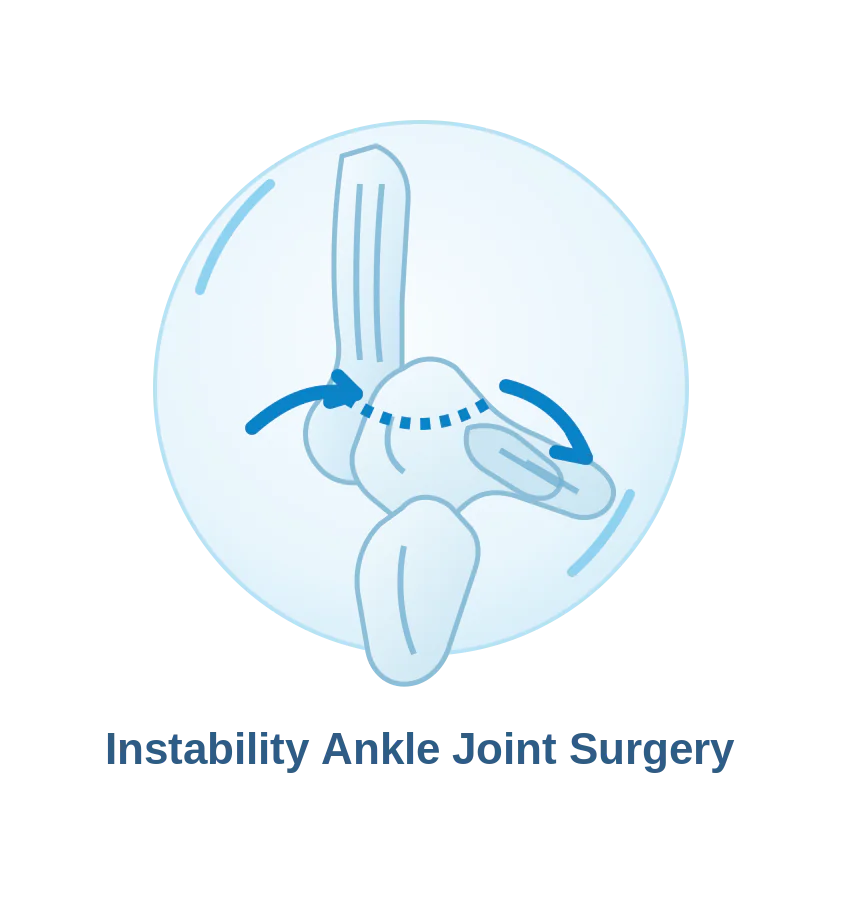 Ankle joint instability and ligament assessment