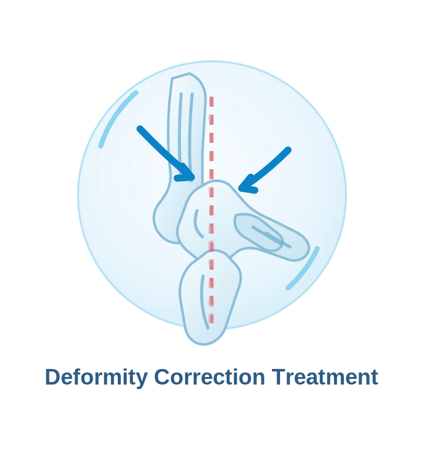 Ankle deformity correction and alignment assessment